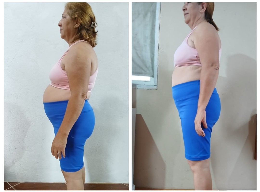 Antes e depois de Adriana