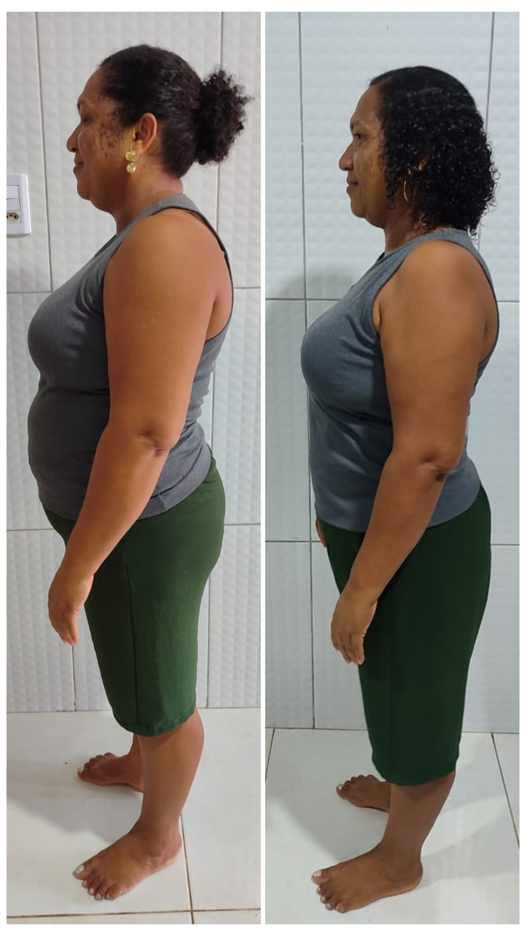 Antes e depois de Joice